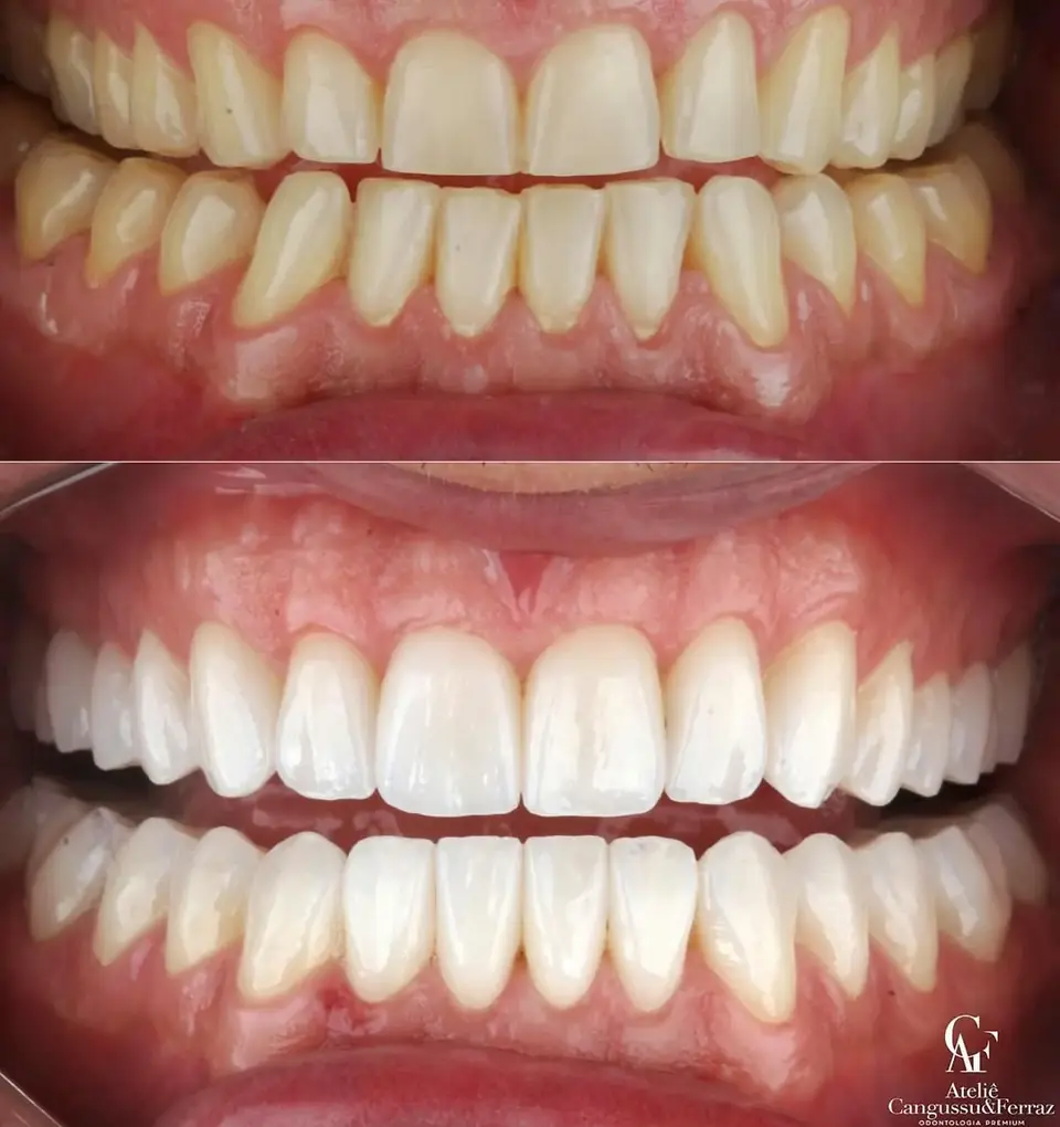 Antes e depois de reabilitação — trabalho do Lab Romanini