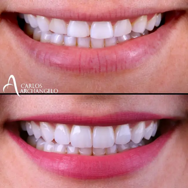 Design do sorriso — trabalho do Lab Romanini